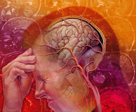TMJ headache--Beverly Hills Chiropractic